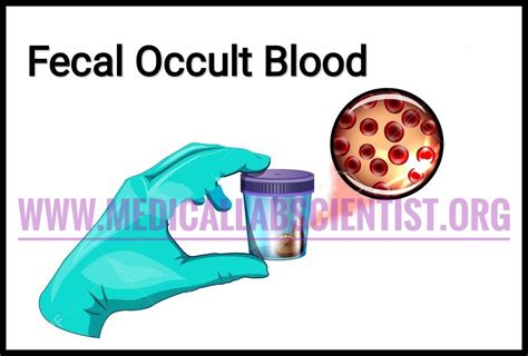 Occult blodo in stool icd 10